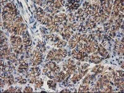 Immunohistochemistry: beta-Catenin Antibody (OTI12H7) - Azide and BSA Free [NBP2-70509]