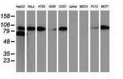Western Blot: beta-Catenin Antibody (OTI12H7)Azide and BSA Free [NBP2-70509]