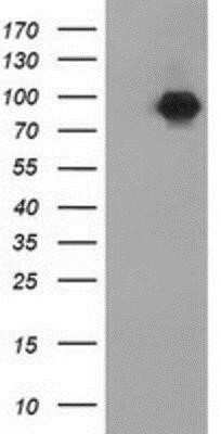 Western Blot: beta-Catenin Antibody (OTI12H7)Azide and BSA Free [NBP2-70509]