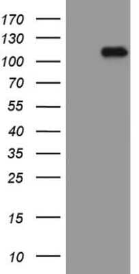 Western Blot: beta-Catenin Antibody (OTI2F10)Azide and BSA Free [NBP2-70511]