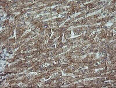 Immunohistochemistry: beta-Catenin Antibody (OTI9C1) - Azide and BSA Free [NBP2-70508]