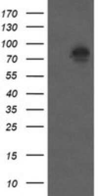 Western Blot: beta-Catenin Antibody (OTI9C1)Azide and BSA Free [NBP2-70508]