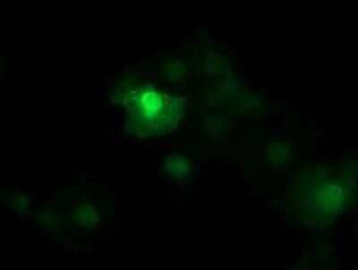 Immunofluorescence: beta-Catenin Antibody (OTI9C1) [NBP2-46400]