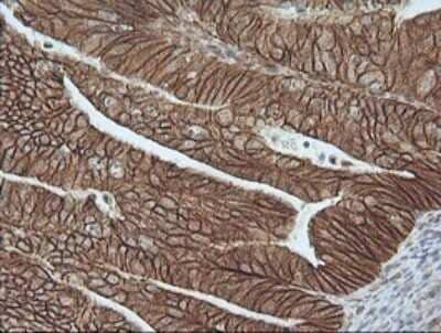 Immunohistochemistry: beta-Catenin Antibody (OTI9C1) [NBP2-46400]