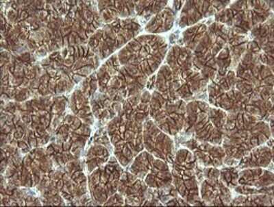 Immunohistochemistry: beta-Catenin Antibody (OTI9C1) [NBP2-46400]