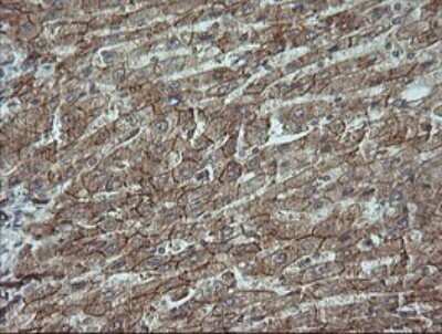 Immunohistochemistry: beta-Catenin Antibody (OTI9C1) [NBP2-46400]