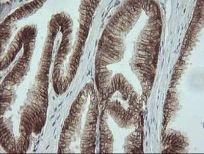 Immunohistochemistry: beta-Catenin Antibody (OTI9C1) [NBP2-46400]