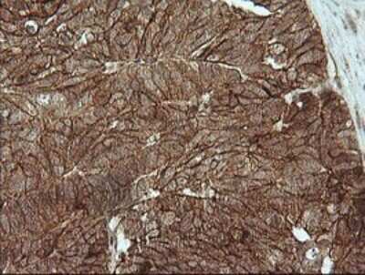 Immunohistochemistry: beta-Catenin Antibody (OTI9C1) [NBP2-46400]