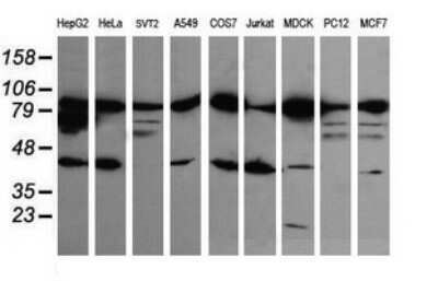 Western Blot: beta-Catenin Antibody (OTI9C1) [NBP2-46400]