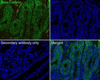 Immunohistochemistry-Paraffin: beta-Catenin Antibody (SA30-04) [NBP2-67307]