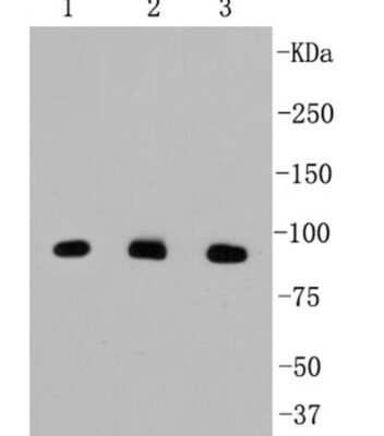 Western Blot: beta-Catenin Antibody (SA30-04) [NBP2-67307]