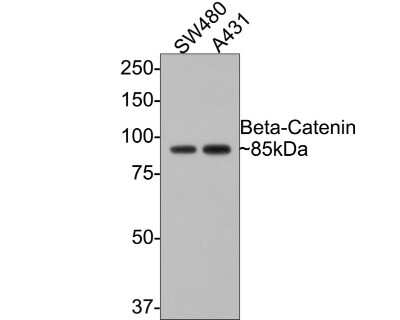 Western Blot: beta-Catenin Antibody (SA30-04) [NBP2-67307]