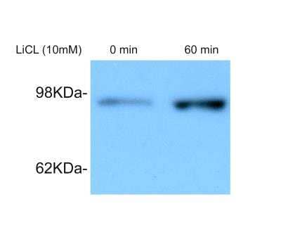 Western Blot: beta-Catenin Antibody [NBP1-32239]
