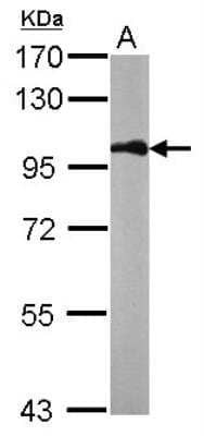 Western Blot: beta-Catenin Antibody [NBP1-32239]