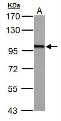 Western Blot: beta-Catenin Antibody [NBP1-32239]