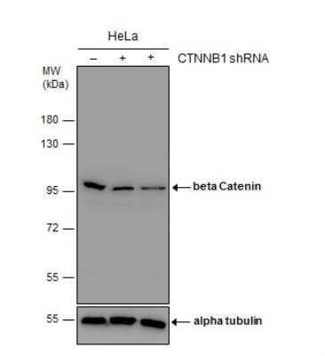 Western Blot: beta-Catenin Antibody [NBP1-32239]