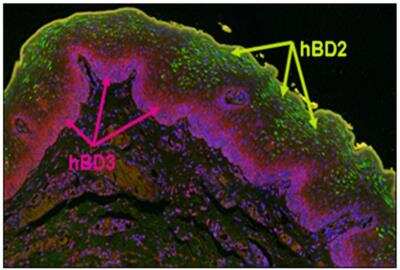 Immunohistochemistry-Paraffin: beta-Defensin 3 Antibody - BSA Free [NB200-117]