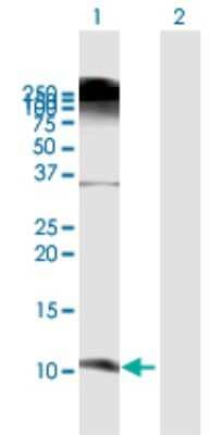 Western Blot: beta-Defensin 3 Antibody [H00055894-B01P]