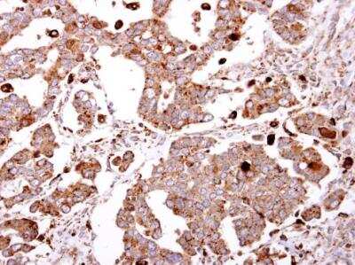 Immunohistochemistry-Paraffin: beta-Galactosidase-1/GLB1 Antibody [NBP1-32018]