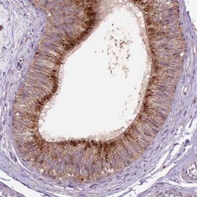 Immunohistochemistry-Paraffin: beta-Galactosidase-1/GLB1 Antibody [NBP2-49602]