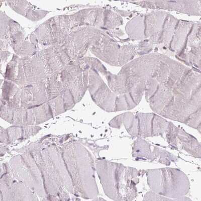 Immunohistochemistry-Paraffin: beta-Galactosidase-1/GLB1 Antibody [NBP2-49602]