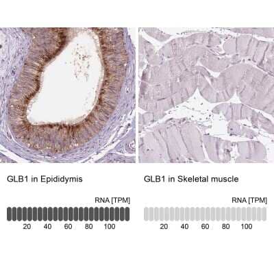 Immunohistochemistry-Paraffin: beta-Galactosidase-1/GLB1 Antibody [NBP2-49602]