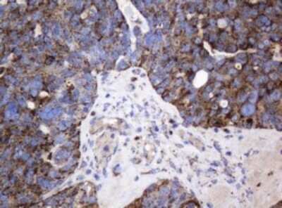 Immunohistochemistry: beta-Galactosidase-1/GLB1 Antibody (OTI1C9) - Azide and BSA Free [NBP2-70829]