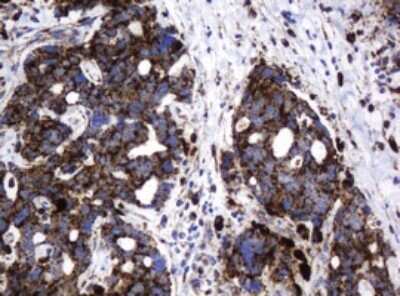 Immunohistochemistry: beta-Galactosidase-1/GLB1 Antibody (OTI1C9) - Azide and BSA Free [NBP2-70829]