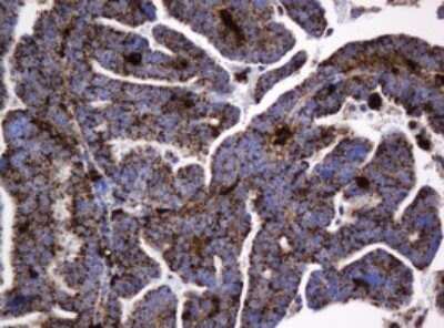 Immunohistochemistry: beta-Galactosidase-1/GLB1 Antibody (OTI1C9) - Azide and BSA Free [NBP2-70829]