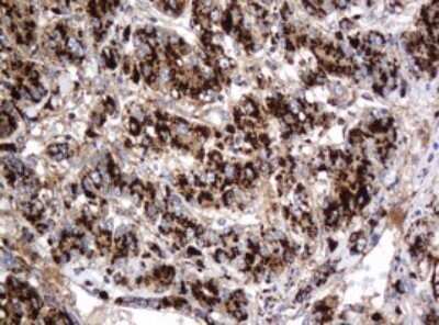 Immunohistochemistry: beta-Galactosidase-1/GLB1 Antibody (OTI1C9) - Azide and BSA Free [NBP2-70829]