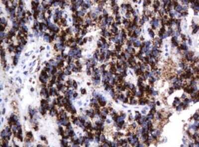 Immunohistochemistry: beta-Galactosidase-1/GLB1 Antibody (OTI1C9) - Azide and BSA Free [NBP2-70829]