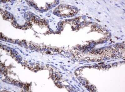 Immunohistochemistry: beta-Galactosidase-1/GLB1 Antibody (OTI1C9) - Azide and BSA Free [NBP2-70829]