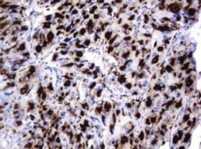 Immunohistochemistry: beta-Galactosidase-1/GLB1 Antibody (OTI1C9) - Azide and BSA Free [NBP2-70829]