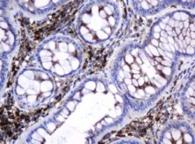 Immunohistochemistry: beta-Galactosidase-1/GLB1 Antibody (OTI1C9) - Azide and BSA Free [NBP2-70829]