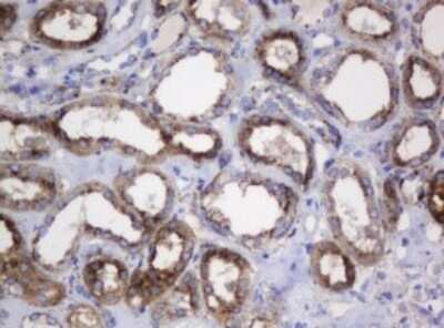 Immunohistochemistry: beta-Galactosidase-1/GLB1 Antibody (OTI1C9) - Azide and BSA Free [NBP2-70829]