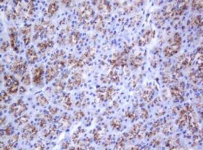 Immunohistochemistry: beta-Galactosidase-1/GLB1 Antibody (OTI1C9) - Azide and BSA Free [NBP2-70829]