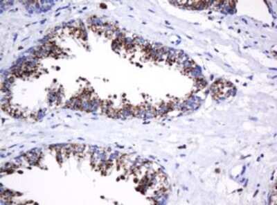Immunohistochemistry: beta-Galactosidase-1/GLB1 Antibody (OTI1C9) - Azide and BSA Free [NBP2-70829]