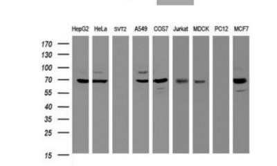 Western Blot: beta-Galactosidase-1/GLB1 Antibody (OTI1C9)Azide and BSA Free [NBP2-70829]