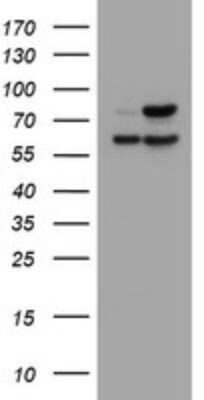 Western Blot: beta-Galactosidase-1/GLB1 Antibody (OTI1C9)Azide and BSA Free [NBP2-70829]