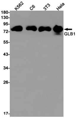 Western Blot: beta-Galactosidase-1/GLB1 Antibody (S01-3G1) [NBP3-15007]