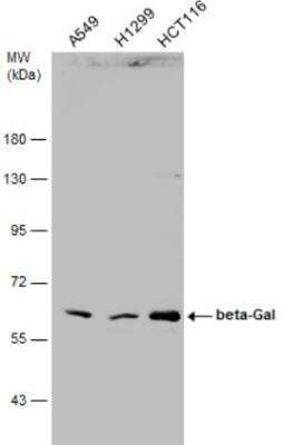 Western Blot: beta-Galactosidase-1/GLB1 Antibody [NBP1-32018]