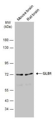 Western Blot: beta-Galactosidase-1/GLB1 Antibody [NBP3-13394]