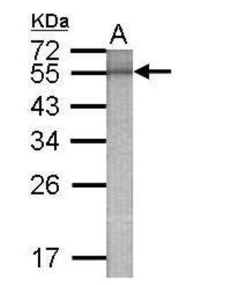 Western Blot: beta Galactosidase Antibody [NBP2-42819]