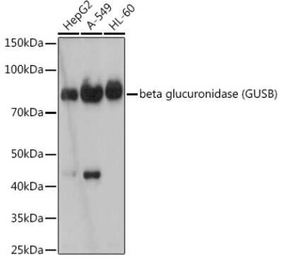 Western Blot: beta-Glucuronidase/GUSB Antibody (4U0E2) [NBP3-15711]