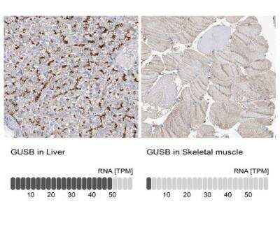 Immunohistochemistry-Paraffin: beta-Glucuronidase/GUSB Antibody [NBP1-87511]