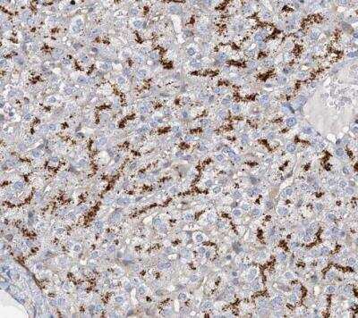 Immunohistochemistry-Paraffin: beta-Glucuronidase/GUSB Antibody [NBP1-87511]