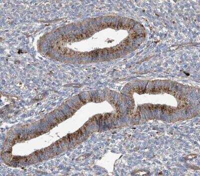 Immunohistochemistry-Paraffin: beta-Glucuronidase/GUSB Antibody [NBP1-87511]