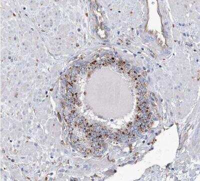 Immunohistochemistry-Paraffin: beta-Glucuronidase/GUSB Antibody [NBP1-87511]