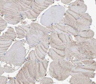 Immunohistochemistry-Paraffin: beta-Glucuronidase/GUSB Antibody [NBP1-87511]