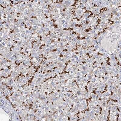 Immunohistochemistry-Paraffin: beta-Glucuronidase/GUSB Antibody [NBP1-87511]